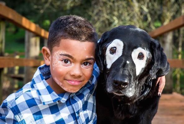 Dog Inspires a Boy To Embrace Rare Skin Condition